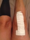 [Bonesmart.org] My Journey as of 12/16/13 - Over 1 Year and Still Trying
