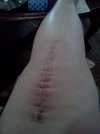 [Bonesmart.org] Roller Coaster Ride Number 2
