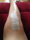 [Bonesmart.org] Bionic knee #2 done 1-21-15