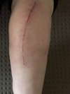 [Bonesmart.org] 12 months later but can’t find my thread