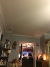 [Bonesmart.org] I just got my new knee.