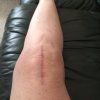 [Bonesmart.org] Bionic LaxMom