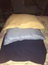 [Bonesmart.org] I just got my new knee.