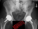 [Bonesmart.org] livendive's thread, +7 & -1 week