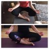 [Bonesmart.org] One hip done, one to go!