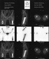[Bonesmart.org] Bill's Bionic Breakdown