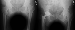 [Bonesmart.org] torment's recovery