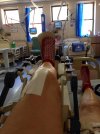 [Bonesmart.org] Nana Moon's Shiny New Second Knee