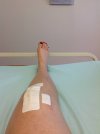 [Bonesmart.org] Raffs' Recovery Thread<'