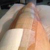 [Bonesmart.org] Rob's Knew Knee