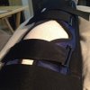 [Bonesmart.org] Rob's Knew Knee