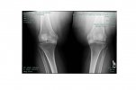 [Bonesmart.org] Looking for OS in Florida Who Will Operate on Obese Patients