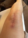 [Bonesmart.org] CATSMUM's new road to recovery