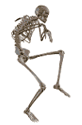[Bonesmart.org] Left hip needs done, have to settle CRPS first