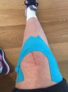 [Bonesmart.org] Raffs' Recovery Thread<'