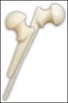 [Bonesmart.org] copsham's recovery thread