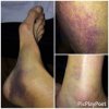 [Bonesmart.org] Recovery the Clipless Way