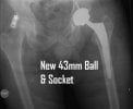 [Bonesmart.org] Plumber's recovery thread