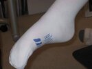 [Bonesmart.org] AussieMike returns
