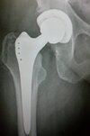 [Bonesmart.org] Damn glad that's over!