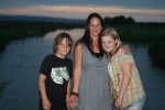 [Bonesmart.org] teenager hip replacement after SUFE