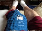 [Bonesmart.org] Unknown lump on front of knee'