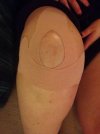 [Bonesmart.org] Raffs' Recovery Thread<'