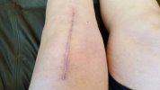 [Bonesmart.org] Freedom works on recovery<<