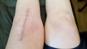 [Bonesmart.org] Freedom works on recovery<<