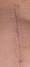 [Bonesmart.org] Rutabaga is recovering!