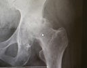 [Bonesmart.org] Newbie Here...7 Days & Counting  :)