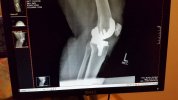 [Bonesmart.org] Freedom works on recovery<<