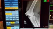 [Bonesmart.org] Freedom works on recovery<<