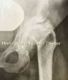 [Bonesmart.org] The marvels of recovery