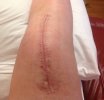[Bonesmart.org] Tabbycat's Recovery<