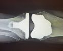 [Bonesmart.org] Tigz's Lessons in Patience