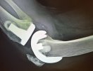 [Bonesmart.org] Tigz's Lessons in Patience