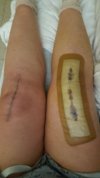 [Bonesmart.org] Freedom's right knee<