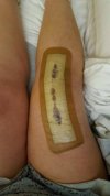 [Bonesmart.org] Freedom's right knee<