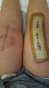 [Bonesmart.org] Freedom's right knee<