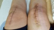 [Bonesmart.org] Freedom's right knee<
