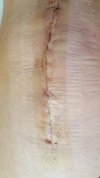 [Bonesmart.org] Freedom's right knee<