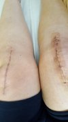 [Bonesmart.org] Freedom's right knee<