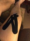 [Bonesmart.org] Papas new knee<