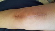 [Bonesmart.org] Freedom's right knee<