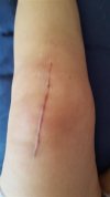 [Bonesmart.org] Freedom's right knee<