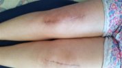 [Bonesmart.org] Freedom's right knee<