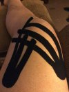 [Bonesmart.org] Papas new knee<