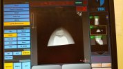 [Bonesmart.org] Freedom's right knee<
