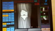 [Bonesmart.org] Freedom's right knee<